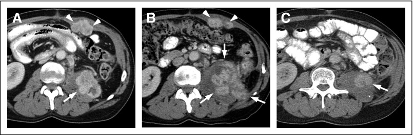 Fig 5.