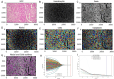 Handcrafted pathomics feature extraction and selection. (A) The most
representative hematoxylin-eosin (HE)–stained image (original
magnification, ×100) of the hepatocellular carcinoma (HCC) sample was
input into CellProfiler software. (B, C) The HE-stained image was split into
hematoxylin-stained and eosin-stained grayscale images. (D–G) Unmixed
images were automatically segmented to identify the nuclei, cell, and
cytoplasm. (H) LASSO (least absolute shrinkage and selection operator)
coefficients profiles (y-axis) of the handcrafted pathomics features. The
lower x-axis indicates the λ value. (I) Fifteen handcrafted pathomics
features were selected into the LASSO model using 10-fold cross-validation
when λ was the minimum loss.
