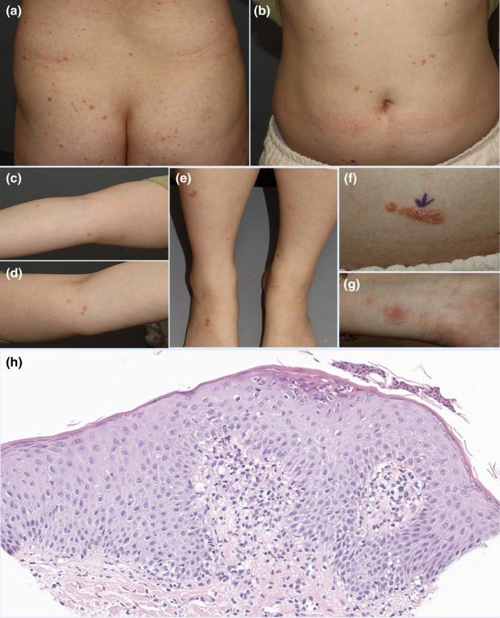 FIGURE 1