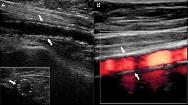 Figure 6