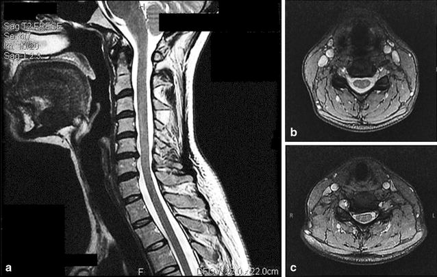 Fig. 3