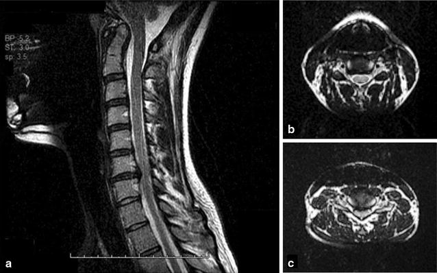 Fig. 1