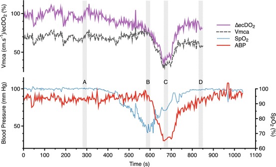 Fig. 4.1