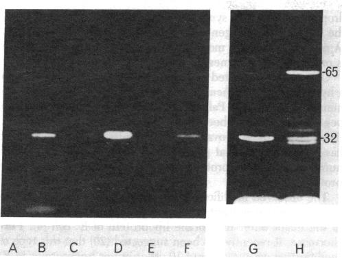 graphic file with name pnas00657-0251-a.jpg