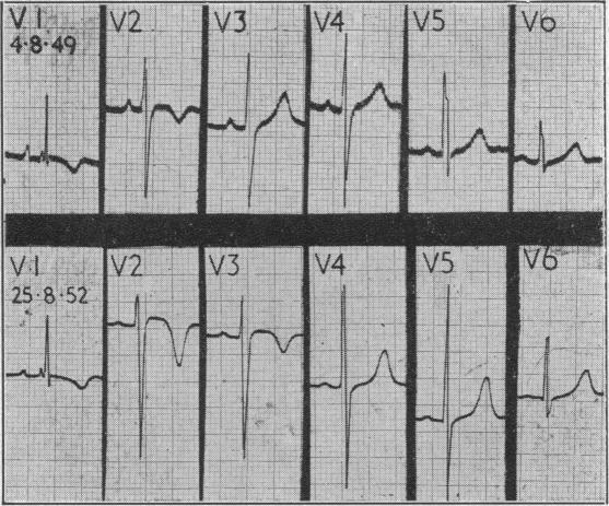 Fig. 11