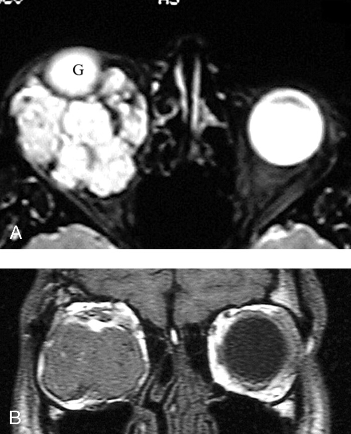 Fig 3.