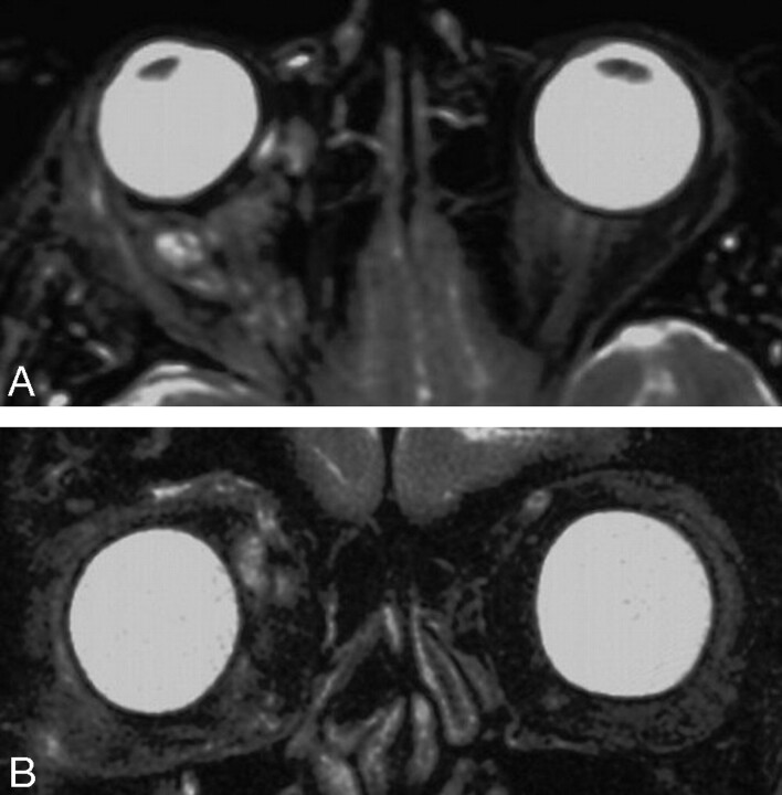 Fig 6.