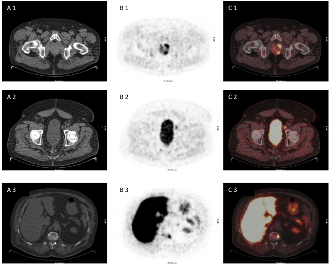 Fig 3