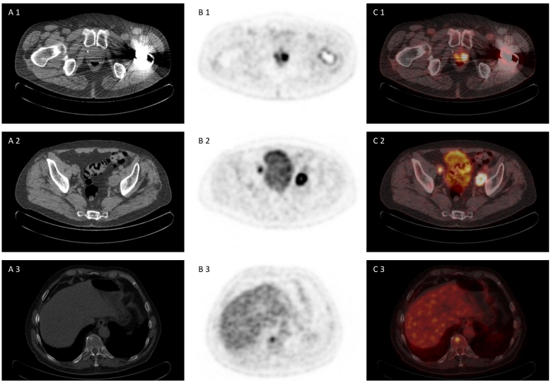 Fig 1