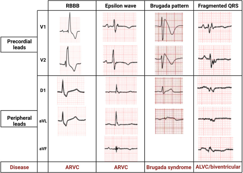 Fig. 2