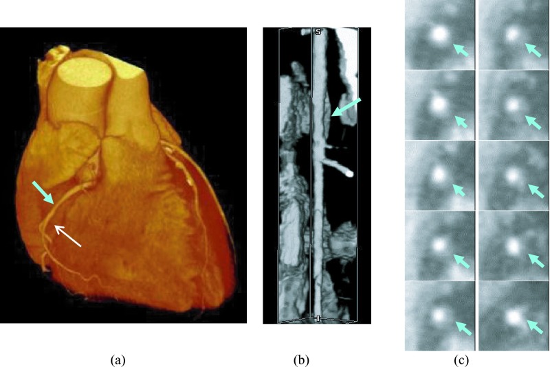 FIG. 5.