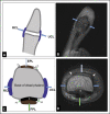 Fig. 17
