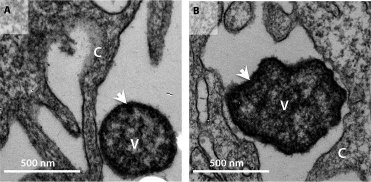 FIG 1