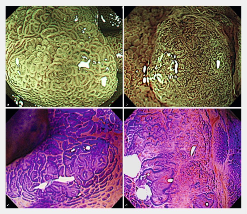 Fig. 1