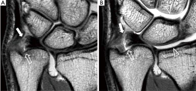 Figure 20