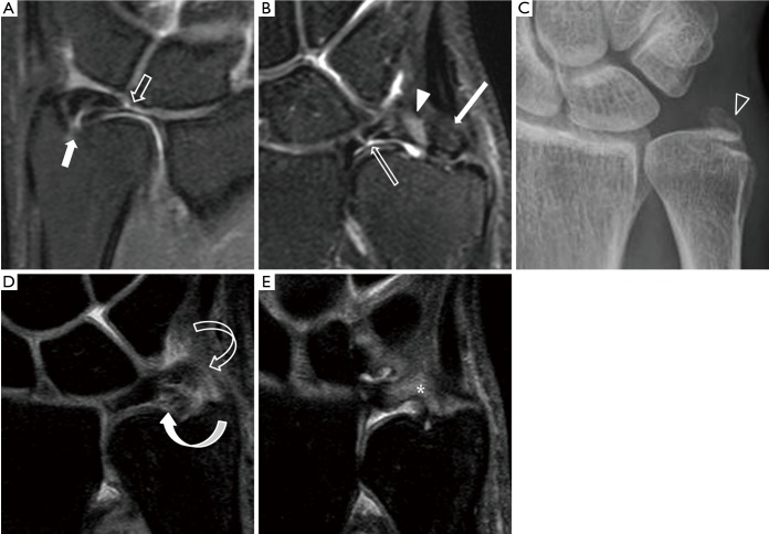 Figure 16