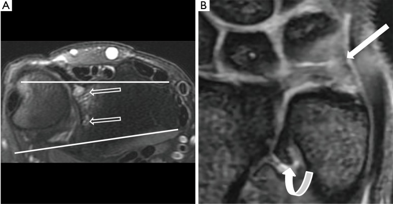 Figure 17