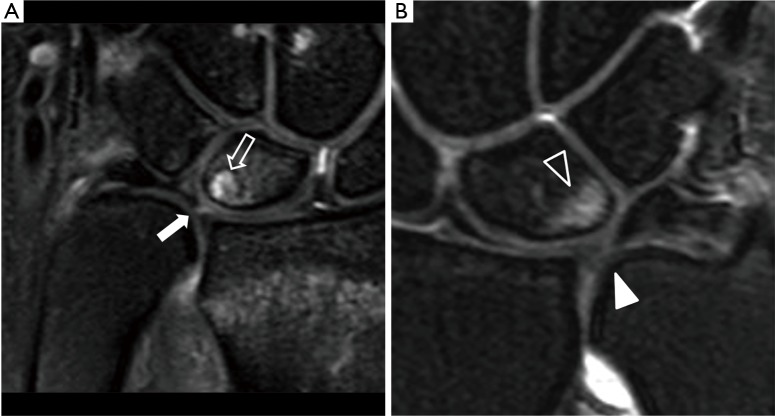 Figure 18