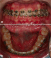 Figure 26