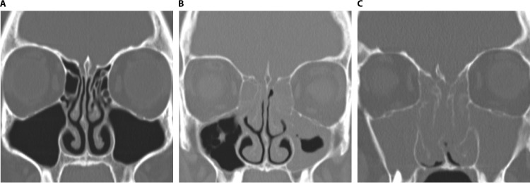 FIG 3