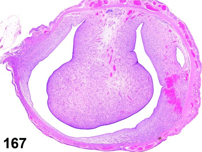 Figure 167