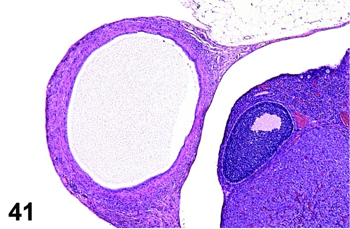 Figure 41