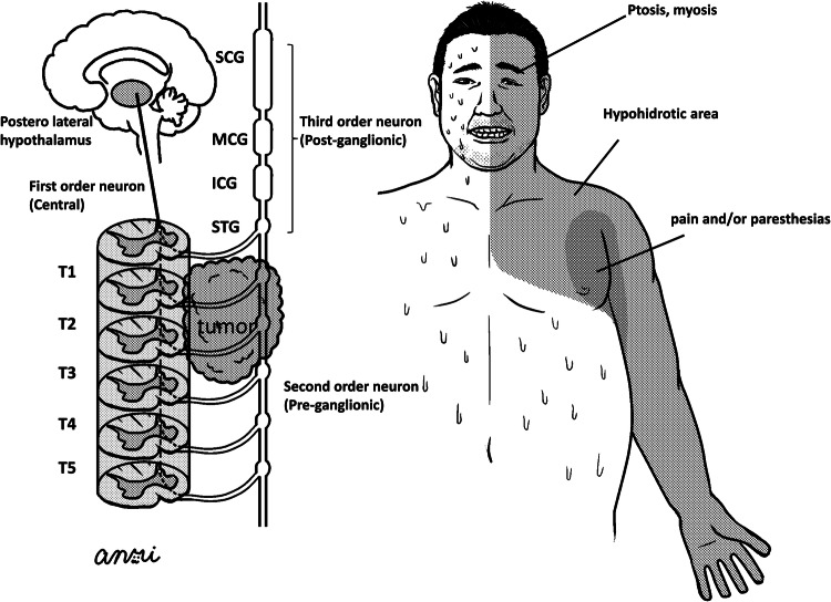 Figure 4