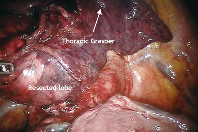 Figure 16