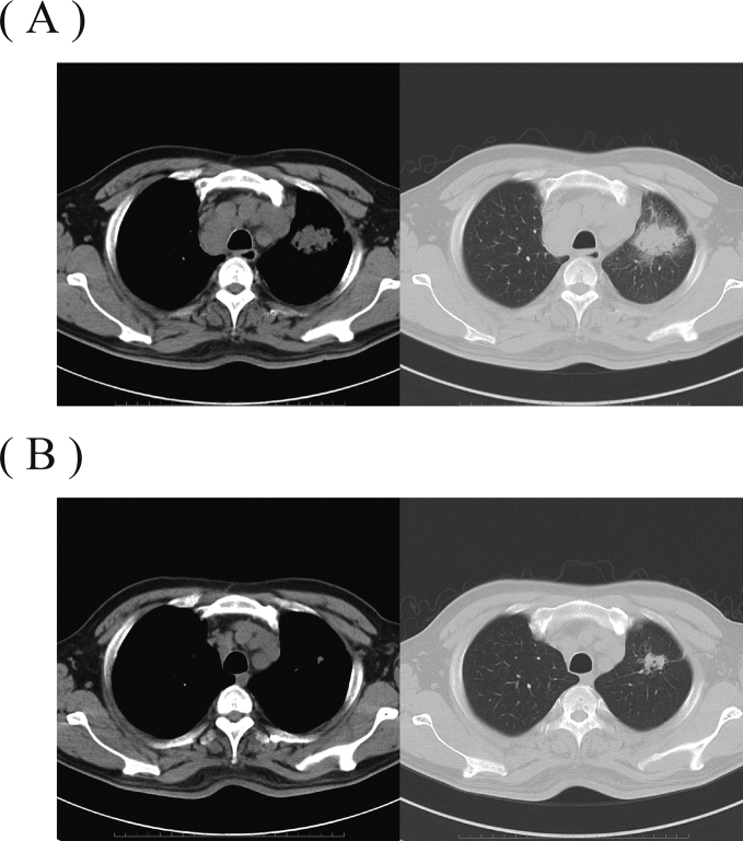 Fig. 1