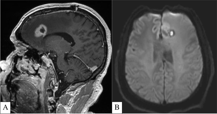 Fig. 5