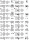 Figure 17—figure supplement 1:
