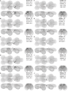 Figure 17—figure supplement 6: