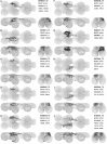 Figure 17—figure supplement 3: