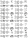 Figure 17—figure supplement 2: