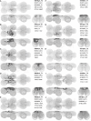 Figure 17—figure supplement 5: