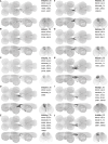 Figure 16—figure supplement 6: