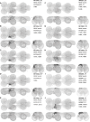 Figure 16—figure supplement 1: