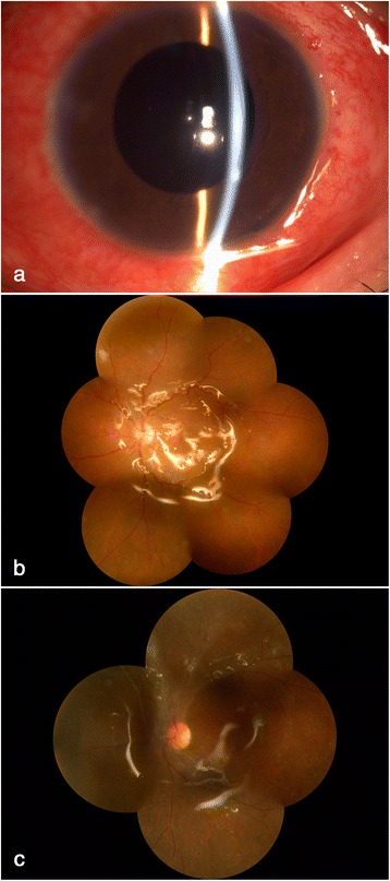 Fig. 2