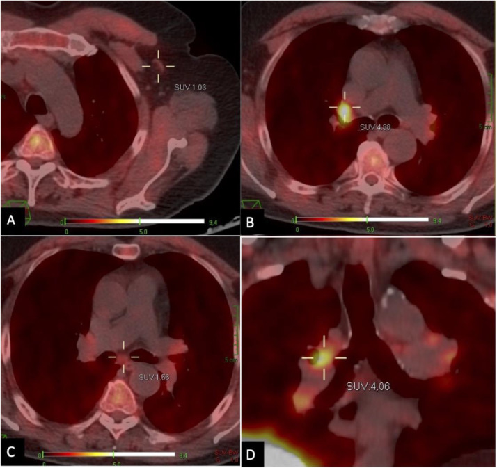 Fig 3