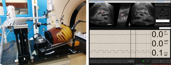 Figure 11