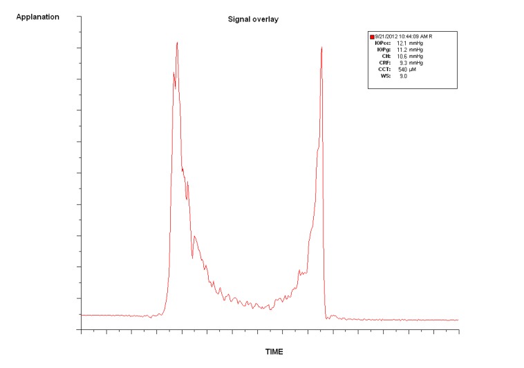 Fig. (1)