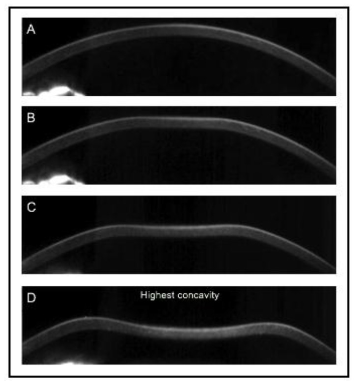 Fig. (2)