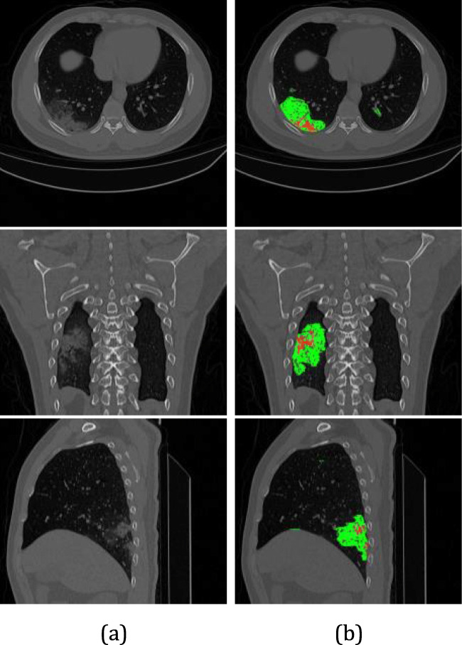 Fig. 12