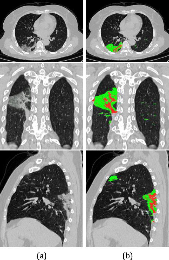 Fig. 9