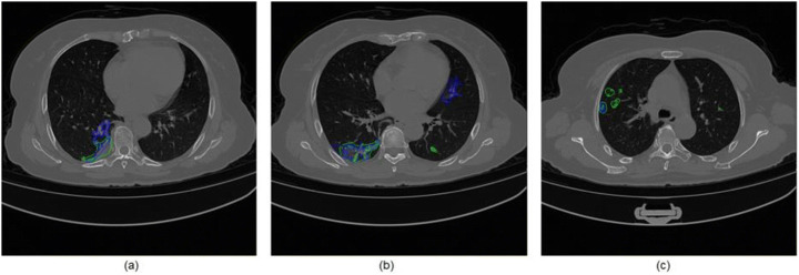 Fig. 13