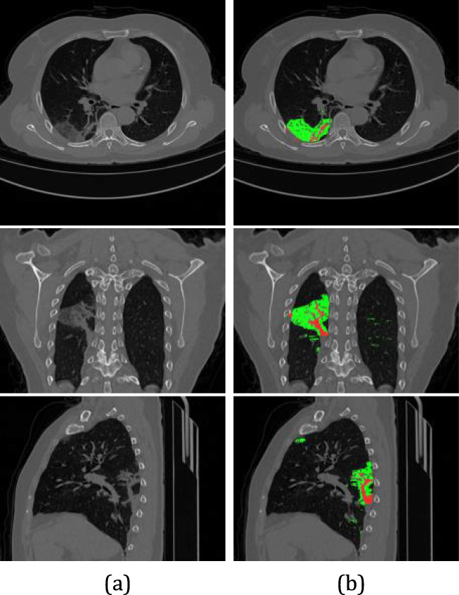 Fig. 14