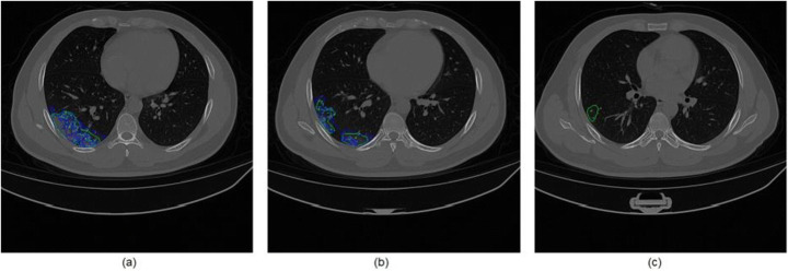 Fig. 11