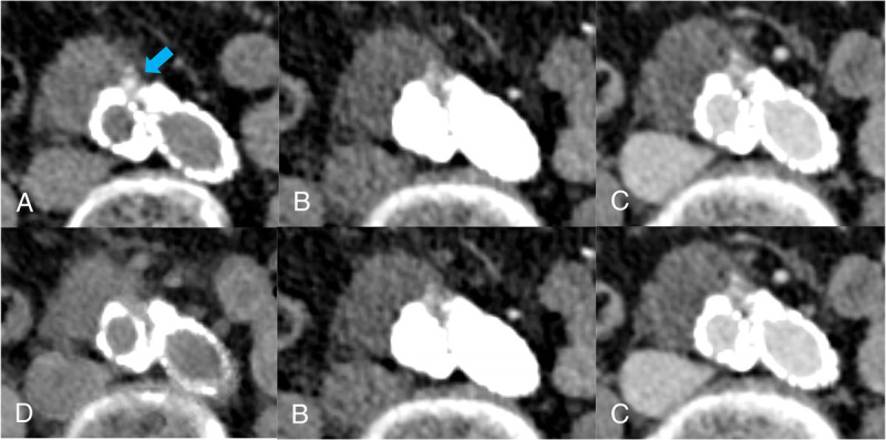 FIGURE 4