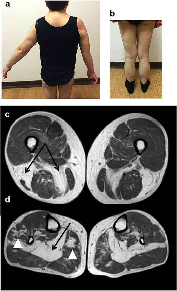 Fig. 1