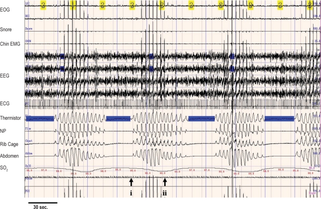 Figure 1A